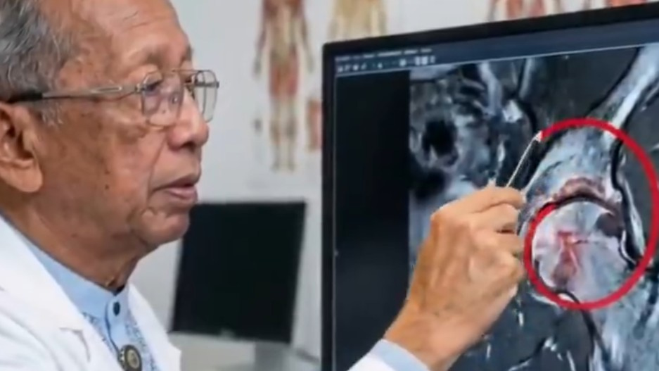 Wajah Dicatut AI untuk Jualan, Prof. Zubairi Djoerban Tegaskan Itu Hoaks